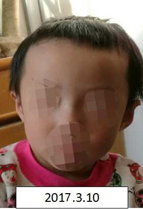 吸烟者有哪些特征